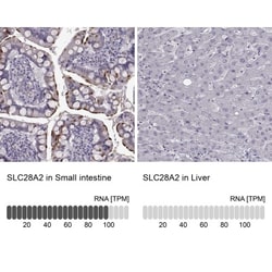 SLC28A2 Antibody, Novus Biologicals 0.1mL; Unlabeled:Antibodies, Polyclonal